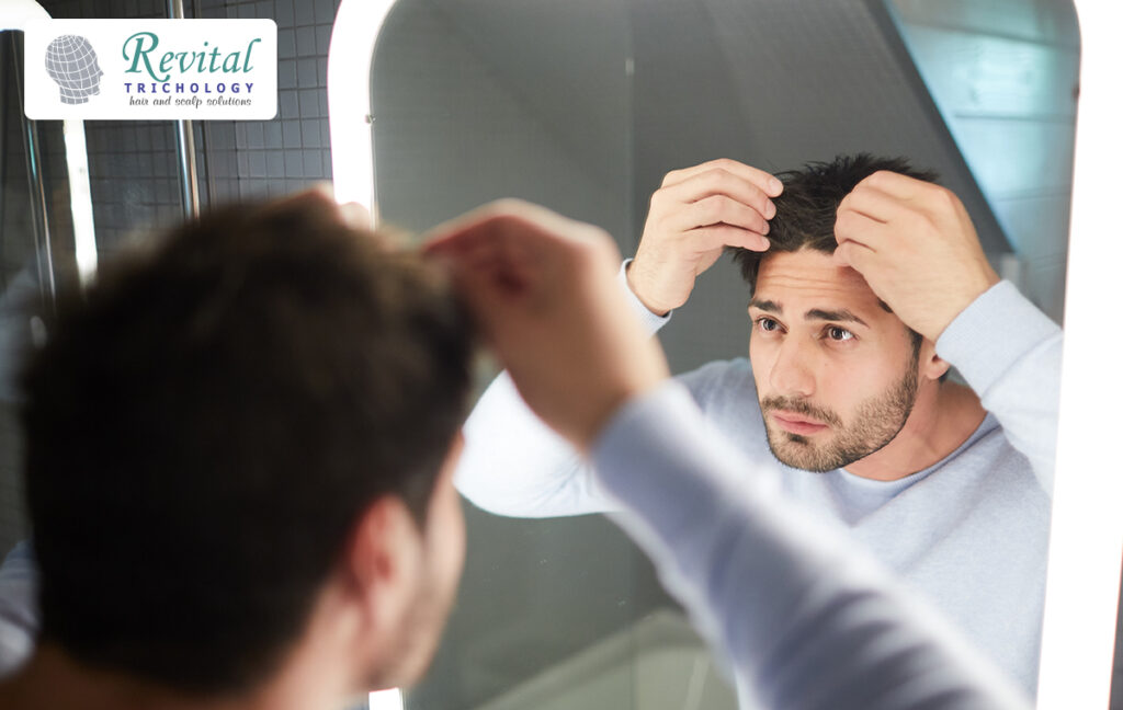 Why Men And Women Face Hair-Fall Problems At An Early Age