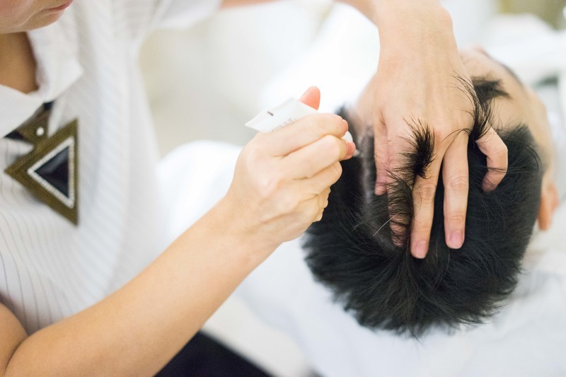 scalp treatment for men